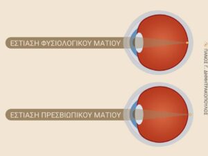 Πρεσβυωπία